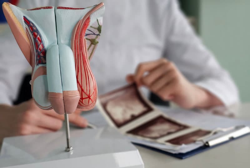 tratamiento disfunción eréctil en Ferrol